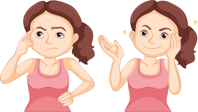 透明質(zhì)酸與黑色素的關(guān)系